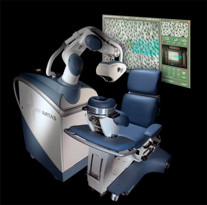 ARTAS - Robotic Hair Transplant Chicago