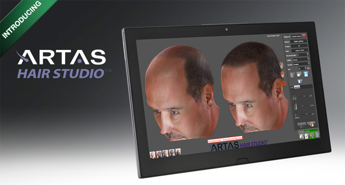 Hair transplantation chicago - visualization