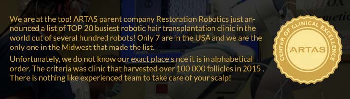 robotic-hair-transplant-artas-best-clinic