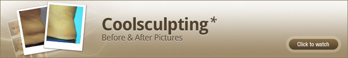 coolsculpting-before-and-after-pictures