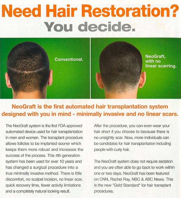 Hair Restoration Chicago
