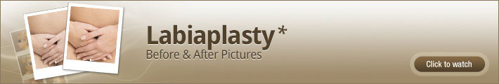 labioplasty-before-and-after-pictures